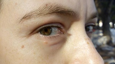 eye_face_eye_close